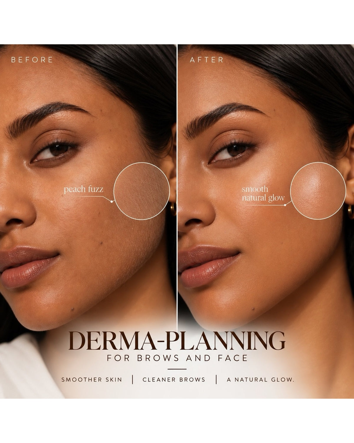 Before-and-after dermaplaning results showing peach fuzz removed for smoother skin and cleaner brows.